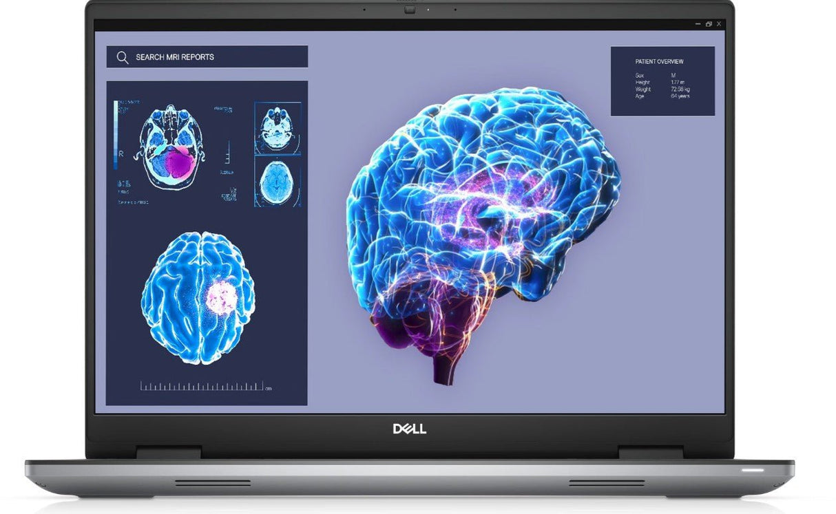 Dell Precision 7680 I7 32GB 1TB SSD 16" W11 Refurbished 5* - Simple kopen bij Microforce | Apple - specialist & refurbished expert | Gratis afhalen in Gentbrugge, Antwerpen & Oudenaarde of snelle levering in België!